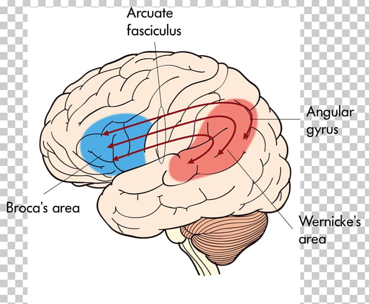 Broca's Area Wernicke's Area Expressive Aphasia Receptive Aphasia PNG, Clipart,  Free PNG Download