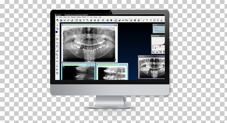 Computer Software Medical Imaging Radiology Rie KaVo Dental GmbH PNG, Clipart, Brand, Computer Monitor, Computer Monitor Accessory, Computer Software, Dentistry Free PNG Download