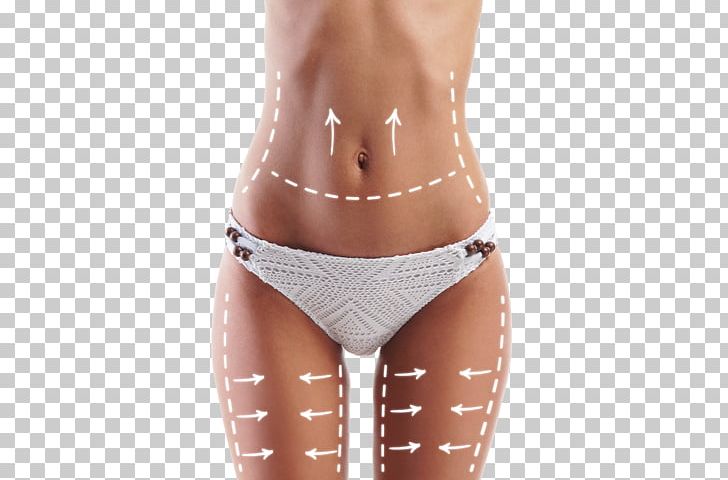 Weight Loss Adipose Tissue Liposuction Mud Wrap Cellulite PNG, Clipart, 3d Arrows, Abdomen, Active Undergarment, Human Body, Lose Free PNG Download