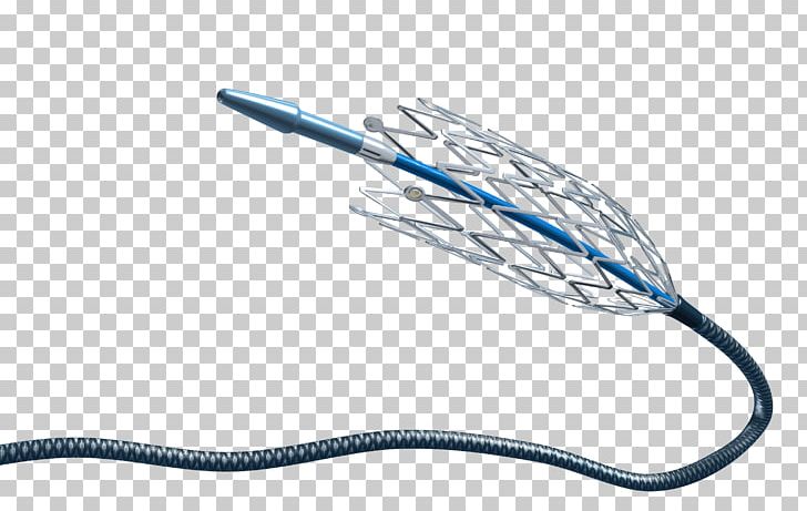 Stenting Nickel Titanium Interventional Radiology Medicine Self-expandable Metallic Stent PNG, Clipart, Cardiology, Coronary Stent, Eleni, Health Care, Heart Free PNG Download