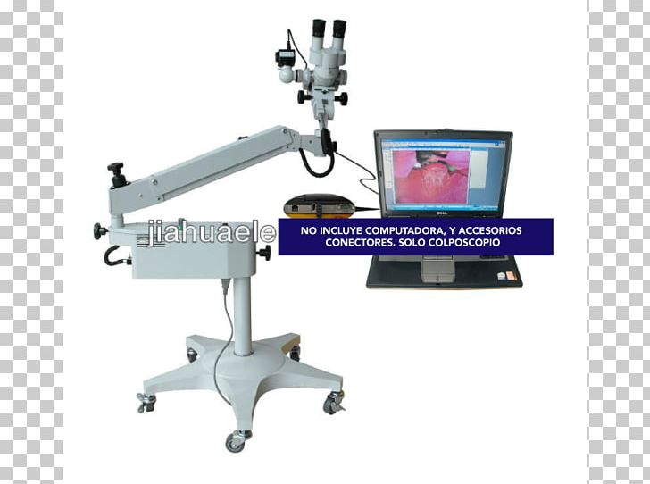 Colposcopy Microscope Gynaecology Medicine Colposcopio PNG, Clipart, Cervix, Colposcopy, Computer Monitor Accessory, Gynaecology, Hardware Free PNG Download