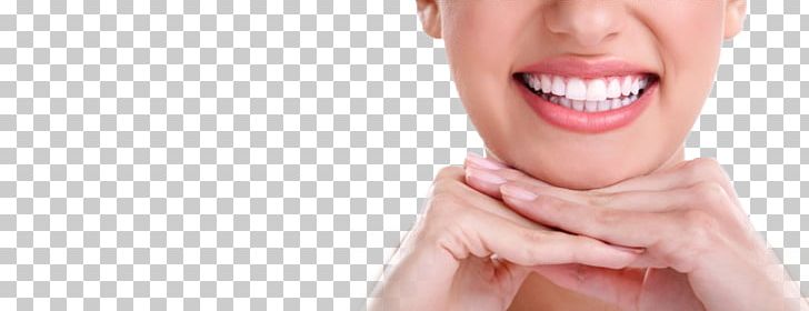 Tooth Whitening Human Tooth Dentistry Smile PNG, Clipart, Arm, Beauty, Cheek, Cosmetic Dentistry, Dental Braces Free PNG Download