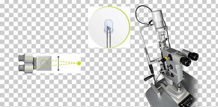 Nd:YAG Laser Capsulotomy Slit Lamp Iridectomy Photodisruption PNG, Clipart, Angle, Auto Part, Capsulotomy, Career, Gaussian Beam Free PNG Download