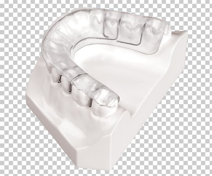 Jaw Mandible Occlusal Splint Maxilla PNG, Clipart, Angle, Bionator, Dorsal Fin, Dynaflex, Fin Free PNG Download