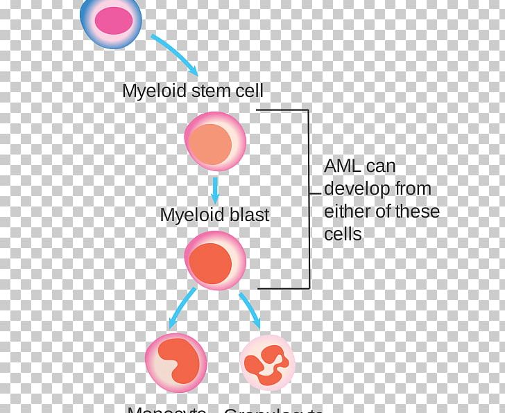 White Blood Cell Acute Myeloid Leukemia PNG, Clipart, Acute Myeloid Leukemia, Aml, Area, Blood, Blood Cell Free PNG Download