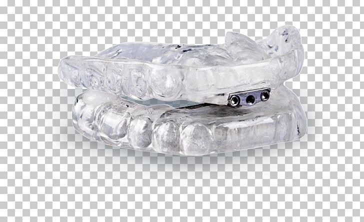 Mouthguard Mandibular Advancement Splint Dentistry Sleep Apnea PNG, Clipart, Apnea, Appliance, Body Jewelry, Crystal, Dental Implant Free PNG Download