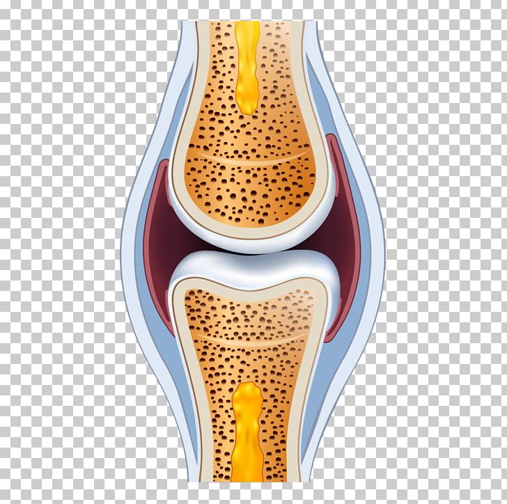 San Francisco Stem Cell Treatment Center Vitamin D Therapy Bone Calcium PNG, Clipart, Arthritis Pain, Bone, Bone Health, Calcium, Cartilage Free PNG Download