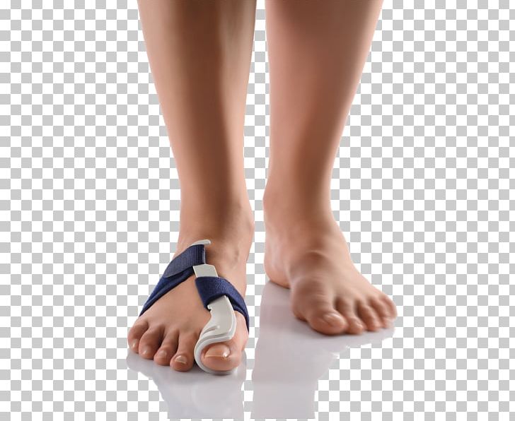 Bunion Splint Toe Foot Orthotics PNG, Clipart, Ankle, Bunion, Calf, Foot, Hallux Free PNG Download