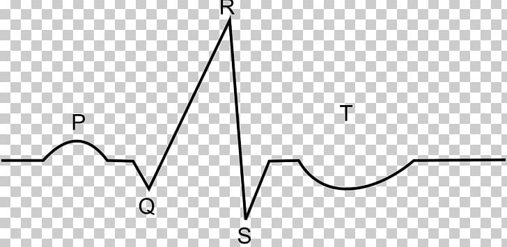 ECG Interpretation Electrocardiography Atrial Fibrillation PNG, Clipart, Angle, Area, Atrial Fibrillation, Atrium, Black And White Free PNG Download