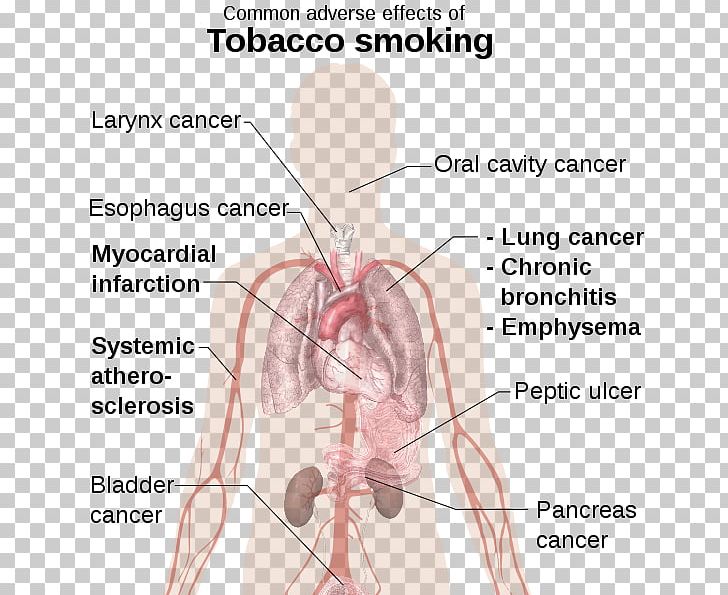 Tobacco Smoking Smoking Cessation Adverse Effect PNG, Clipart, Abdomen, Angle, Arm, Face, Hand Free PNG Download