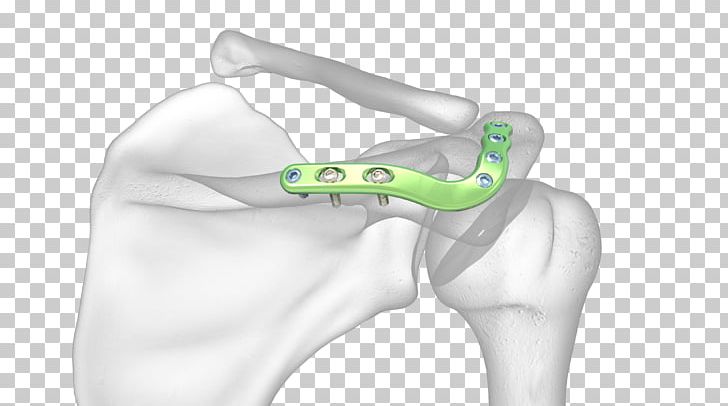 Thumb Acromion Shoulder Joint Scapula PNG, Clipart, Abdomen, Acromion, Anatomy, Arm, Bone Free PNG Download