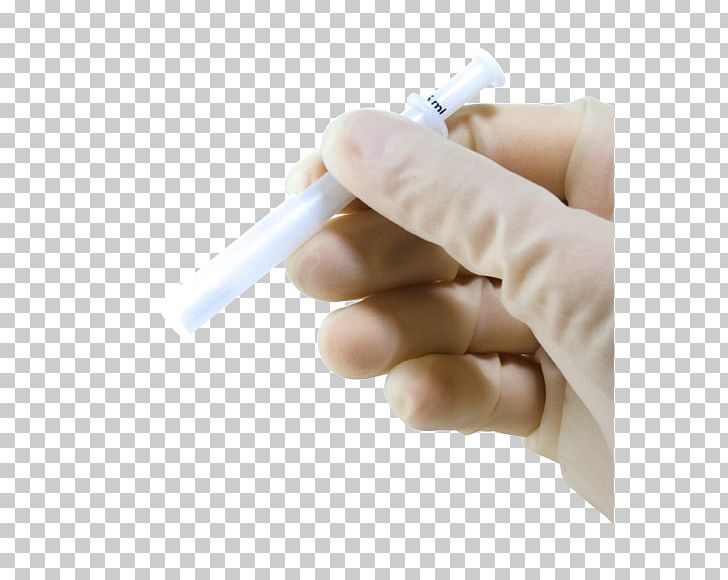 Surgery Anesthesia Bone Benzocaine Therapy PNG, Clipart, Anesthesia, Benzocaine, Bone, Collagen, Finger Free PNG Download