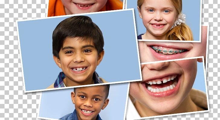 Stellar Kids Dentistry Mill Creek Pediatric Dentistry Child PNG, Clipart, Child, Chin, Cosmetic Dentistry, Dentist, Dentistry Free PNG Download