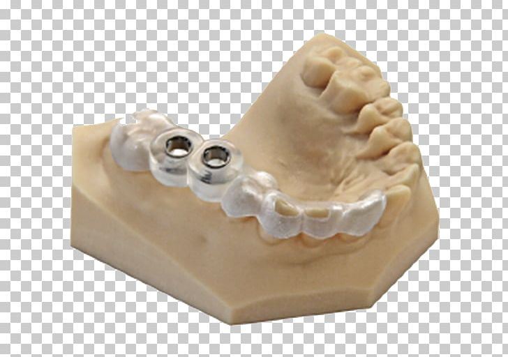 3D Printing Rapid Prototyping 3D Computer Graphics Dentistry PNG, Clipart, 3d Computer Graphics, 3d Modeling, 3d Printing, 3d Systems, Beige Free PNG Download