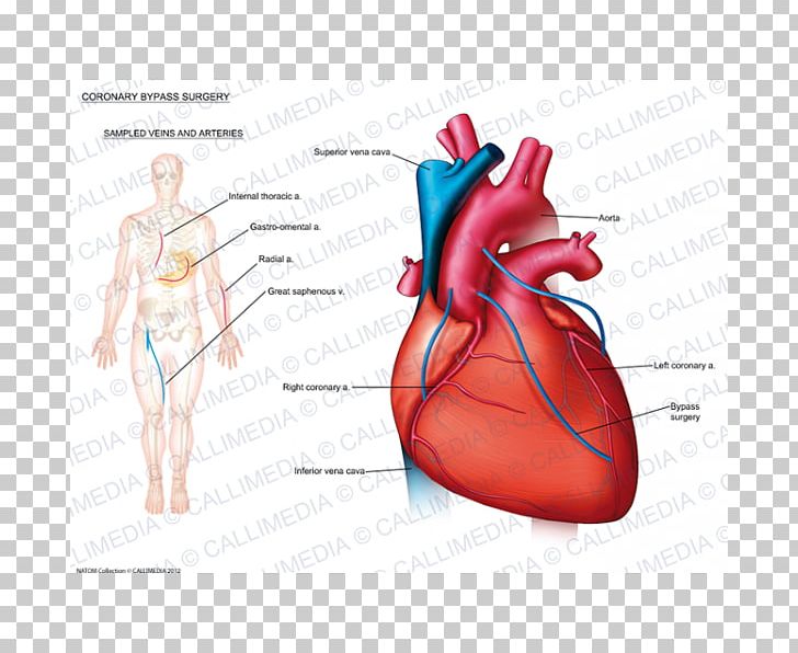 Heart Disease: A Textbook Of Cardiovascular Medicine Anatomy Coronary Artery Disease Cardiology PNG, Clipart, Anatomy, Cardiology, Cardiovascular Disease, Circulatory System, Coronary Artery Bypass Surgery Free PNG Download