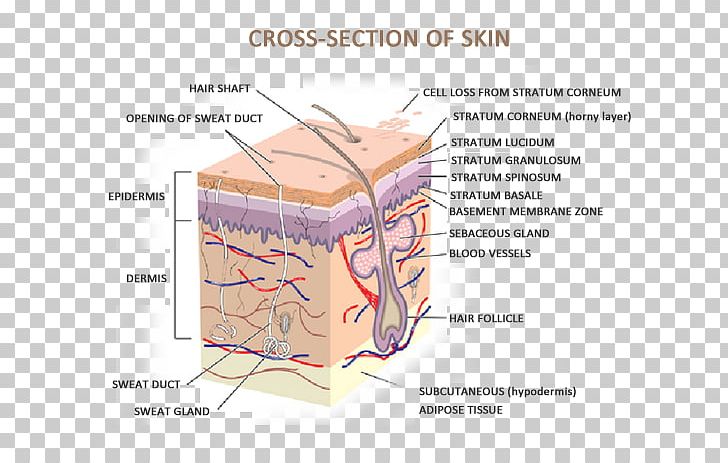 Human Skin Anatomy The Skin And Common Disorders Human Body PNG, Clipart, Anatomy, Angle, Cross Section, Dermis, Diagram Free PNG Download