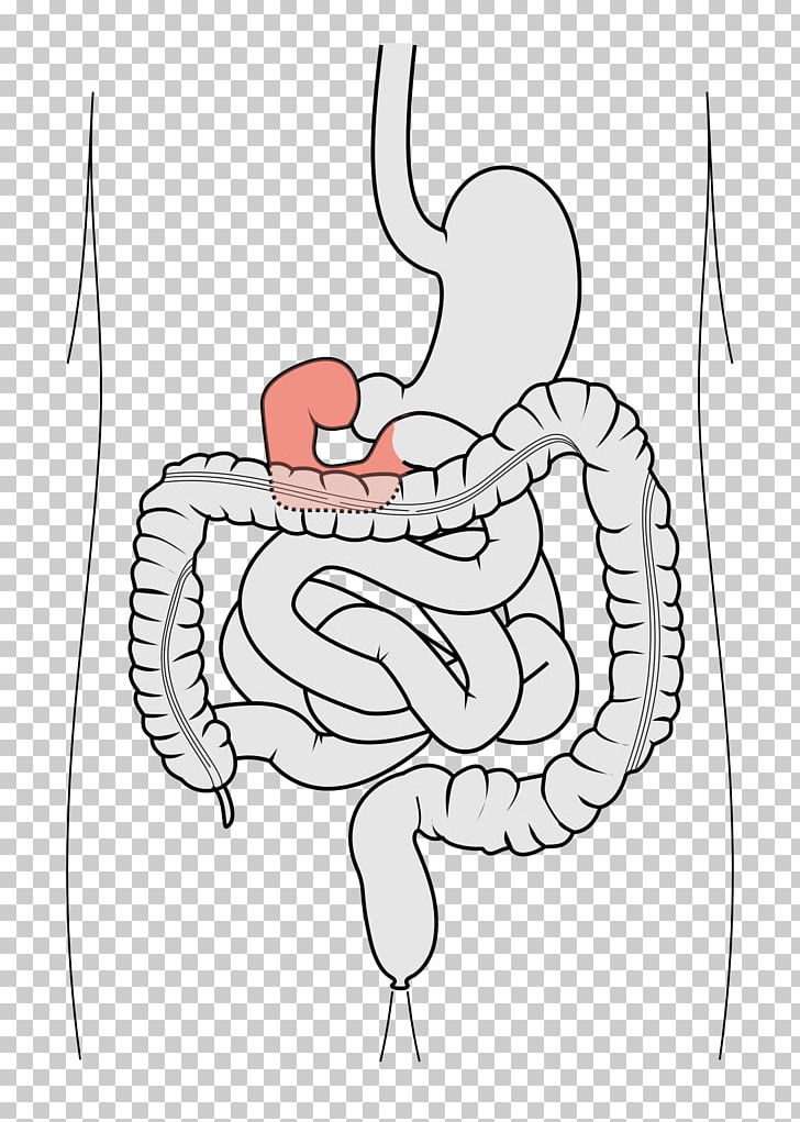 Duodenum Small Intestine Gastrointestinal Tract Large Intestine Jejunum PNG, Clipart, Angle, Arm, Bird, Cartoon, Chicken Free PNG Download