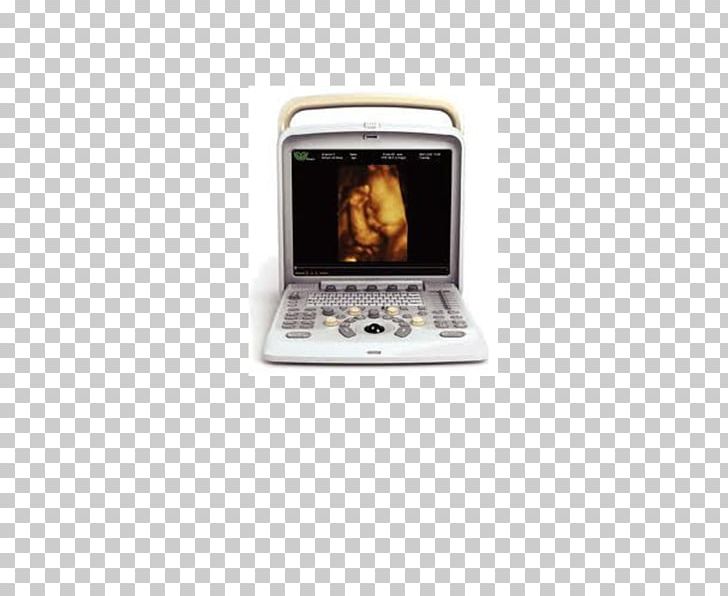 Ultrasonography Portable Ultrasound Doppler Echocardiography Medical Imaging PNG, Clipart, Audi Q5, Doppler Echocardiography, Doppler Ultrasonography, Electronics, Medical Imaging Free PNG Download