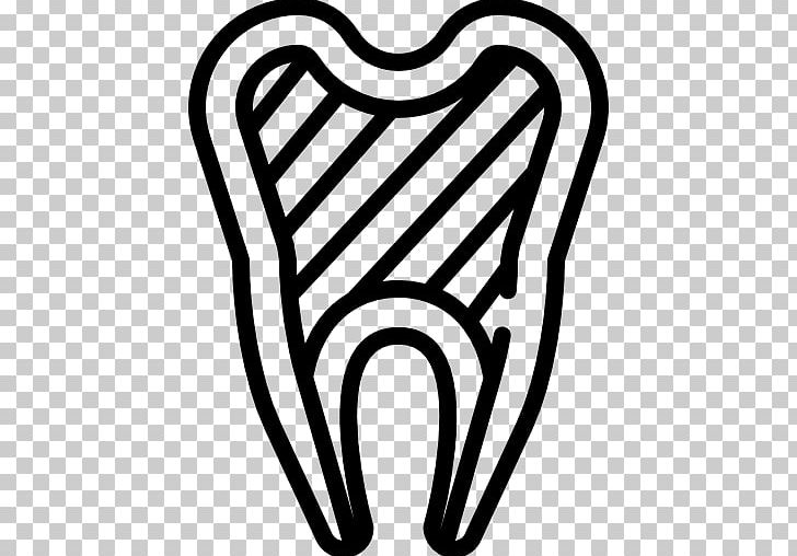 Dentistry Tooth Endodontics Endodontic Therapy PNG, Clipart, Black And White, Clinic, Dentist, Dentistry, Dentures Free PNG Download