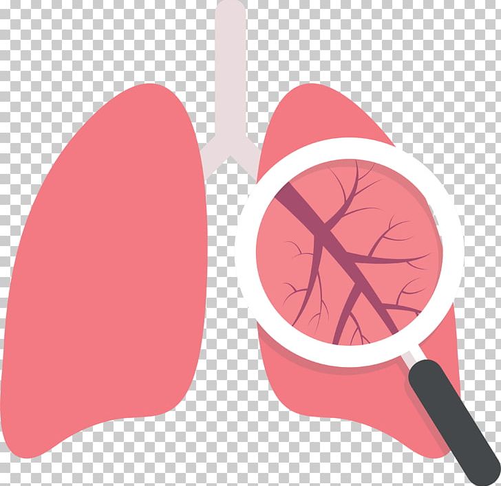Lung Transplantation Cough Disease Pulmonology PNG, Clipart, Cancer, Cough, Disease, Doc, Finger Free PNG Download