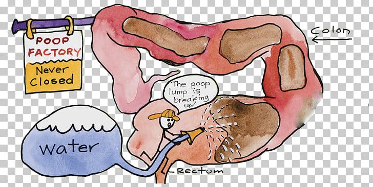 Colon Cleansing Detoxification Hydrotherapy Large Intestine Enema PNG, Clipart, Abdomen, Anus, Area, Arm, Cartoon Free PNG Download
