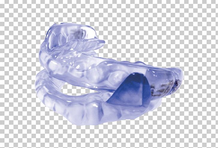 Mandibular Advancement Splint Orthodontics Dentistry Snoring Sleep Apnea PNG, Clipart,  Free PNG Download