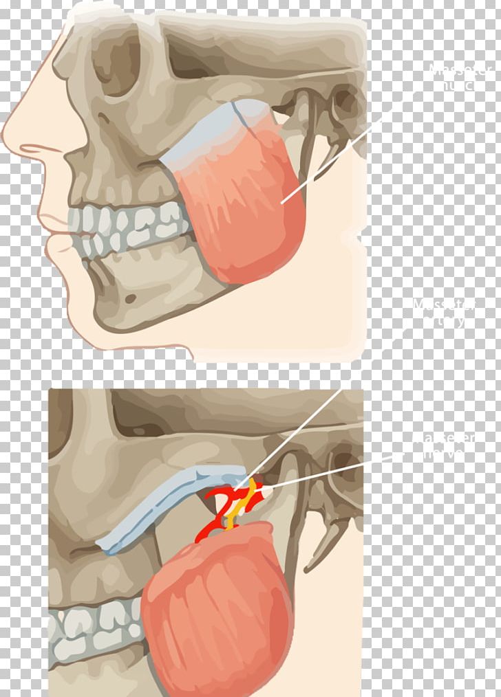 Muscles Of Mastication Masseter Muscle Lateral Pterygoid Muscle Temporomandibular Joint Medial Pterygoid Muscle PNG, Clipart, Anatomy, Chewing, Digastric Muscle, Ear, Finger Free PNG Download