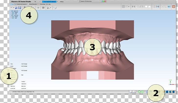 Dentistry Computer Software Product Manuals Open Dental Orthodontics PNG, Clipart, Computer Hardware, Computer Software, Dental, Dentistry, Ear Free PNG Download
