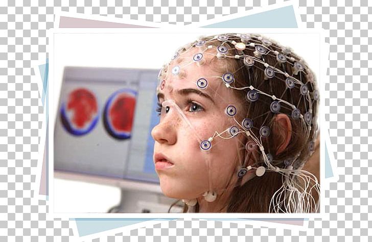 Electroencephalography Epilepsy Meningioma Disease Symptom PNG, Clipart, Ana Sayfa, Brain, Brain Tumor, Cheek, Child Free PNG Download