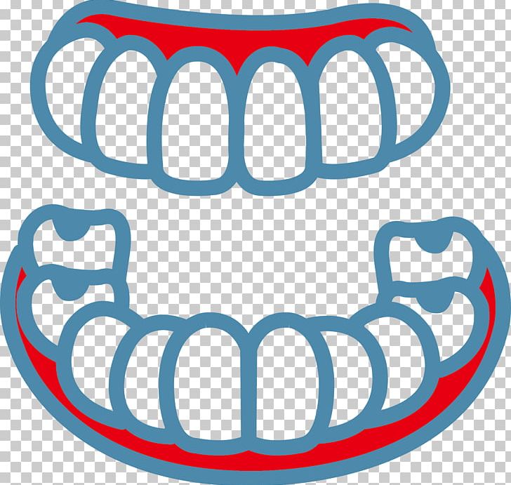 Tooth Pathology Mouth Lip PNG, Clipart, Area, Biomedical Cosmetic Surgery, Biomedical Engineering, Biomedical Industry, Biomedicine Free PNG Download