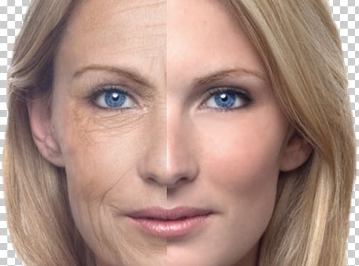 Ageing Skin Old Age Anti-aging Cream Wrinkle PNG, Clipart, Acne, Ageing, Antiaging Cream, Beauty, Blond Free PNG Download