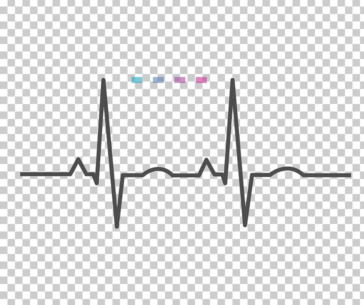 Heart Rate Monitor Pulse PNG, Clipart, Angle, Area, Black, Computer Icons, Diagram Free PNG Download