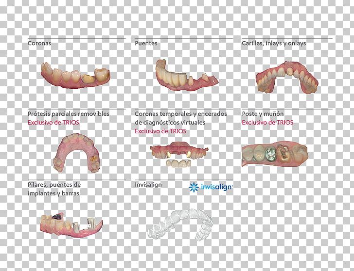 Scanner 3D Scanner 3Shape Digital Data PNG, Clipart, 3d Scanner, 3shape, Business, Computer, Computer Software Free PNG Download