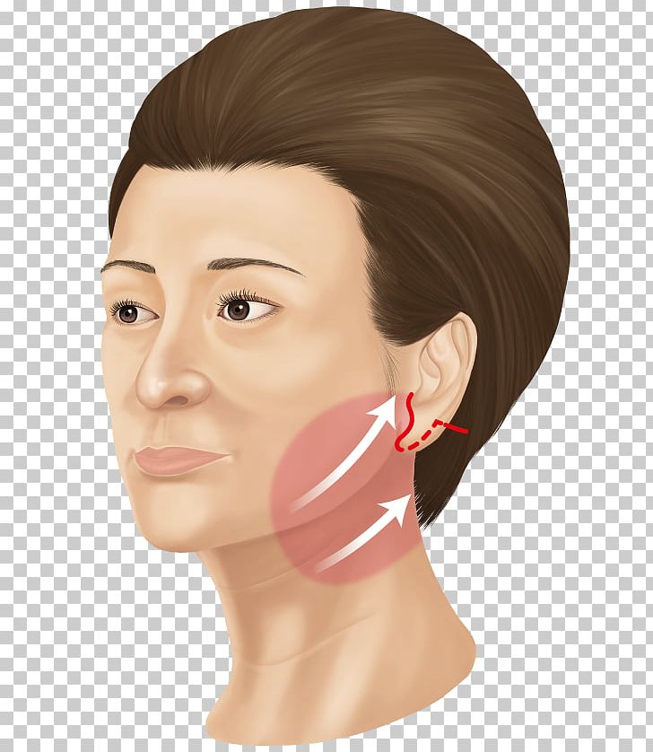 Cheek サフォクリニック Face Forehead 美容外科学 PNG, Clipart, Brown Hair, Cheek, Chin, Ear, Eyebrow Free PNG Download
