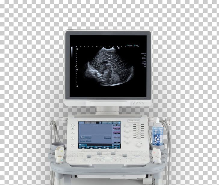 Ultrasound Ultrasonography Medicine Medical Diagnosis Surgery PNG, Clipart, Acuson, Angiology, Canon Medical Systems Corporation, Display Device, Electronics Free PNG Download