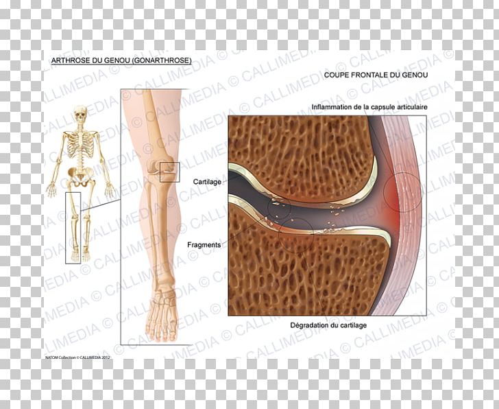 Shoulder Fibular Collateral Ligament Knee PNG, Clipart, Angle, Art, Fibular Collateral Ligament, Joint, Knee Free PNG Download