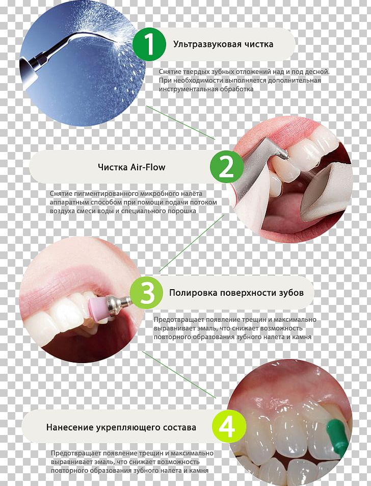 Tooth Brushing Lip Dentistry Human Mouth PNG, Clipart, Dentistry, Human Mouth, Lip, Mouth, Tooth Free PNG Download