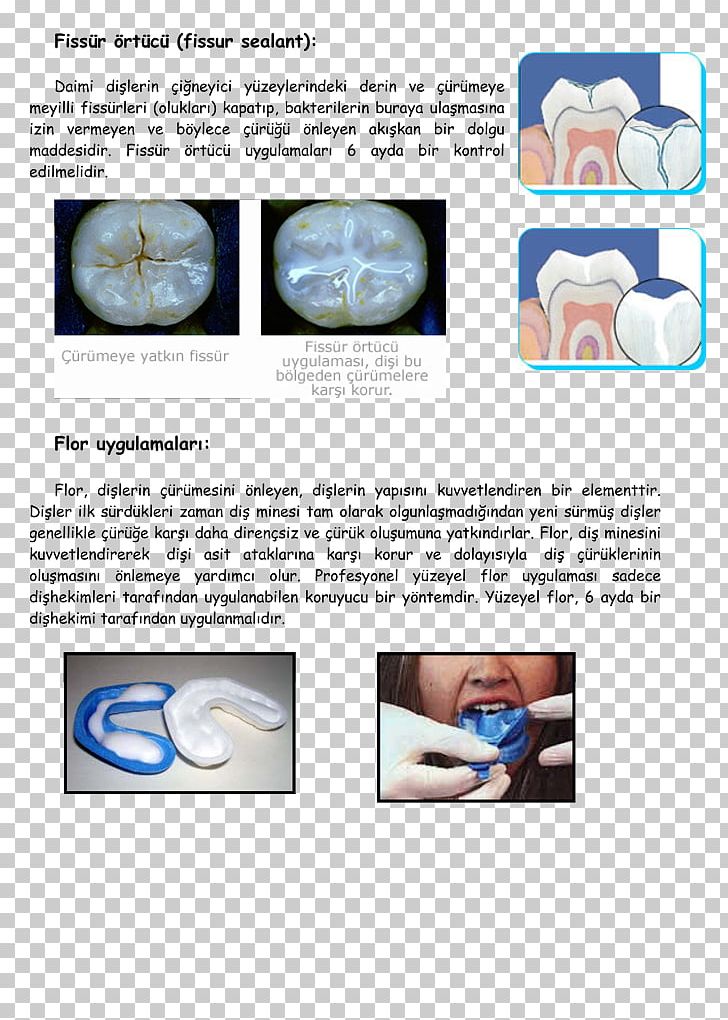 Nose Brochure PNG, Clipart, Brochure, Dali, Fluoride, Jaw, Joint Free PNG Download