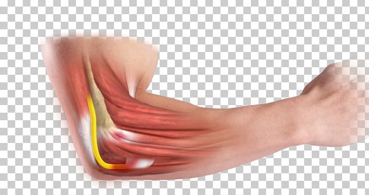 Thumb Cubital Tunnel Ulnar Nerve Entrapment Carpal Tunnel Syndrome PNG, Clipart,  Free PNG Download