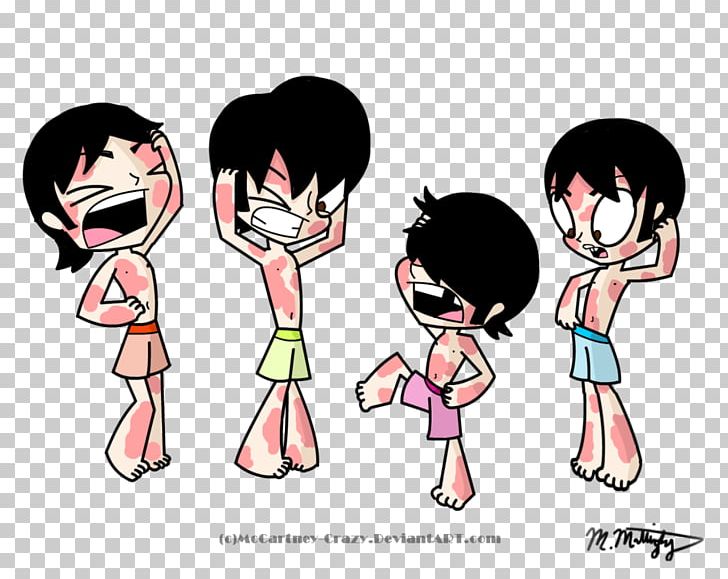 Skin Rash Itch Urticaria Allergy PNG, Clipart, Black Hair, Boy, Cartoon, Child, Clothing Free PNG Download