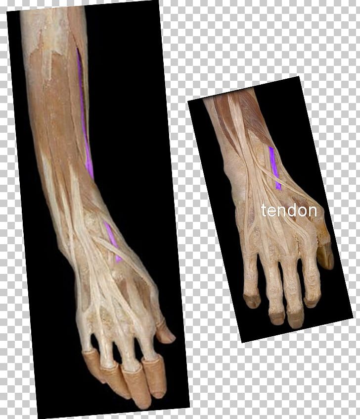 Finger Extensor Digitorum Muscle Extensor Pollicis Longus Muscle Extensor Pollicis Brevis Muscle Flexor Pollicis Longus Muscle PNG, Clipart, Abductor Pollicis Brevis Muscle, Abuse, Accurate, Arm, Brevis Free PNG Download