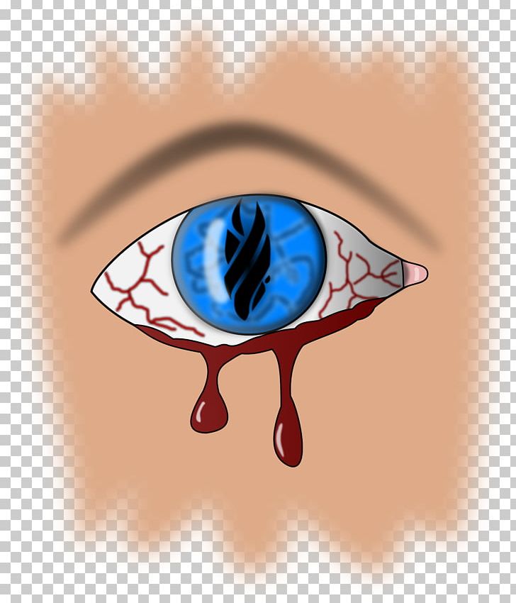Eye Bleeding Heart Retinal Hemorrhage PNG, Clipart, Art, Bleed, Bleeding, Blood, Clip Free PNG Download