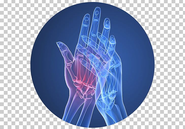 Rheumatoid Arthritis Therapy Disease Pharmaceutical Drug PNG, Clipart, Arthritis, Autoimmunity, Disease, Electric Blue, Golimumab Free PNG Download