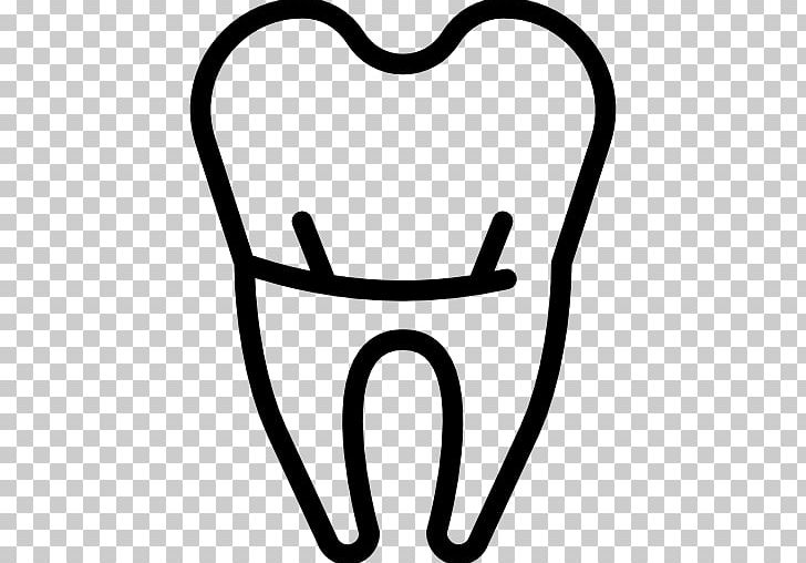 Crown Dentistry Tooth Computer Icons PNG, Clipart, Black And White, Body Jewelry, Dental, Dental Floss, Dental Instruments Free PNG Download