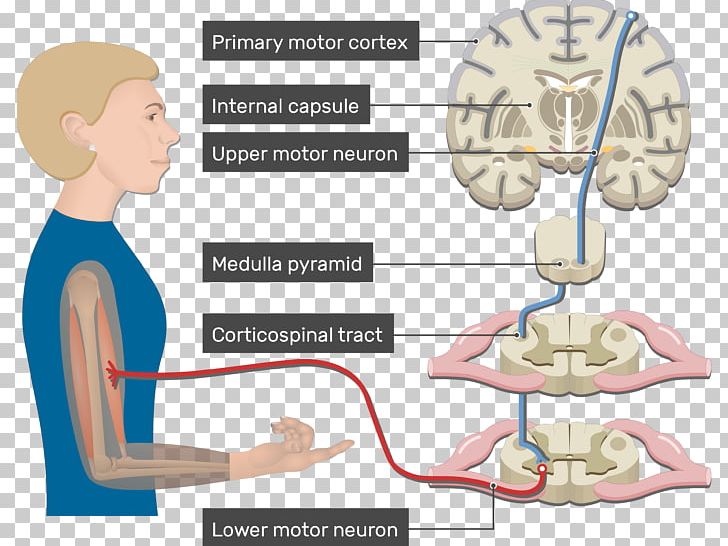 Pyramidal Tracts Lateral Corticospinal Tract Internal Capsule Upper Motor Neuron PNG, Clipart, Arm, Brain, Communication, Cortex System, Corticospinal Tract Free PNG Download