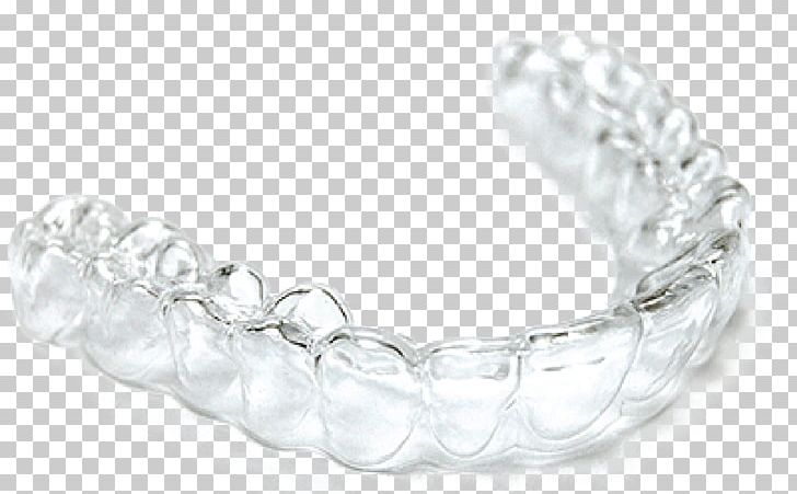 Clear Aligners Dentistry Orthodontics Dental Braces Tooth PNG, Clipart, Bangle, Body Jewelry, Bracelet, Clear Aligners, Dental Free PNG Download