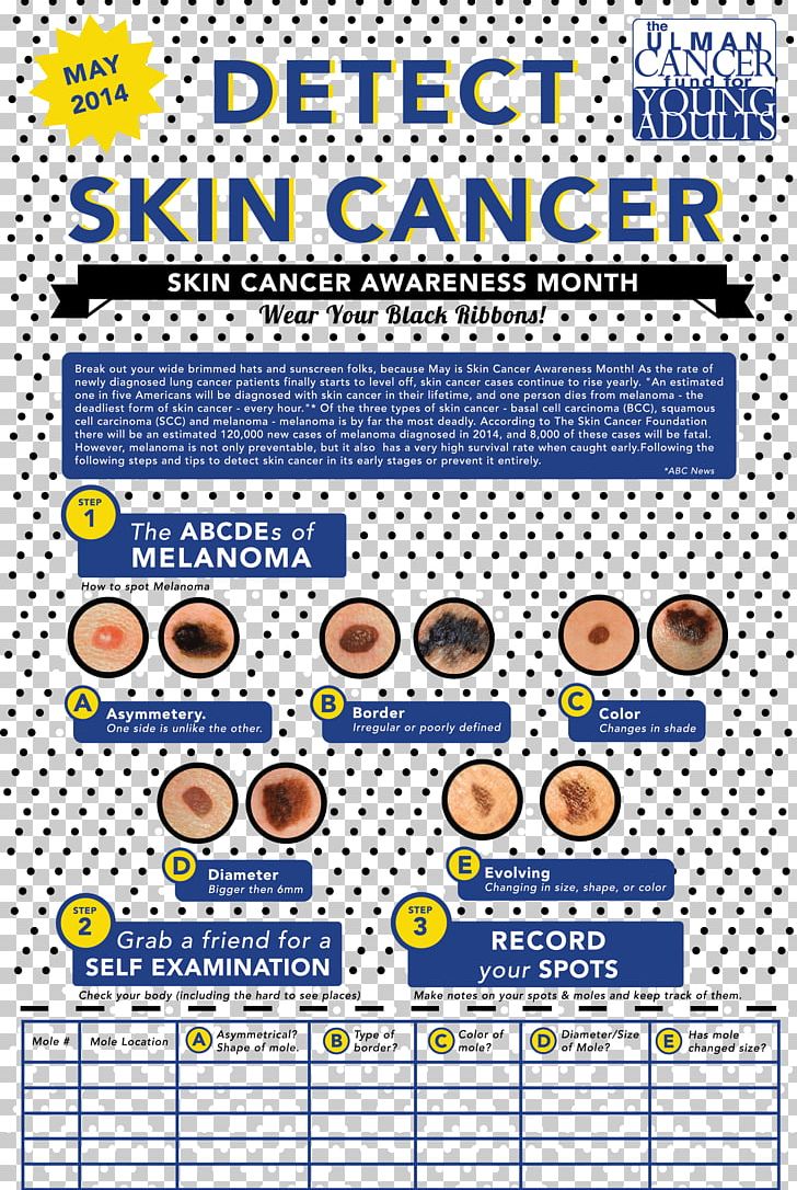 Skin Cancer Foundation Carcinoma Melanoma PNG, Clipart, Area, Awareness Ribbon, Cancer, Cancer Staging, Carcinoma Free PNG Download
