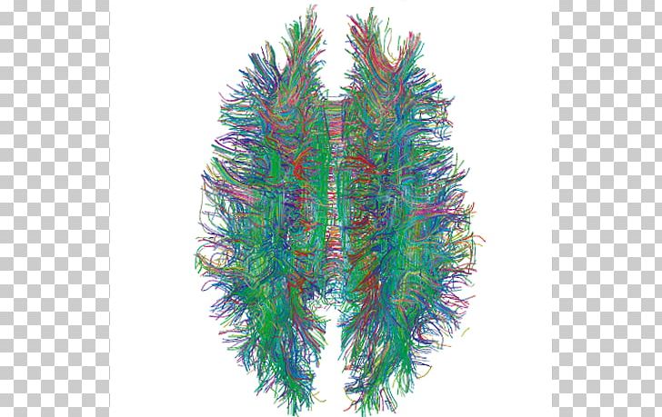 White Matter Brain Human Connectome Project Central Nervous System PNG, Clipart, Aquarium Decor, Brain, Central Nervous System, Connectome, Diffusion Mri Free PNG Download