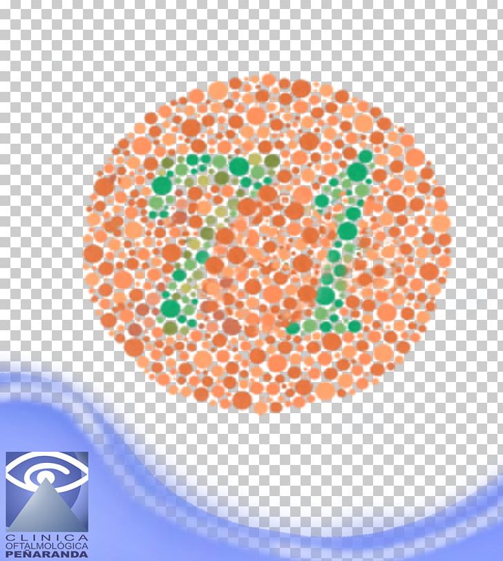 Ishihara Test Color Blindness Eye Examination Vision Impairment Color Vision PNG, Clipart, Circle, Color, Color Blindness, Color Vision, Dalton Free PNG Download