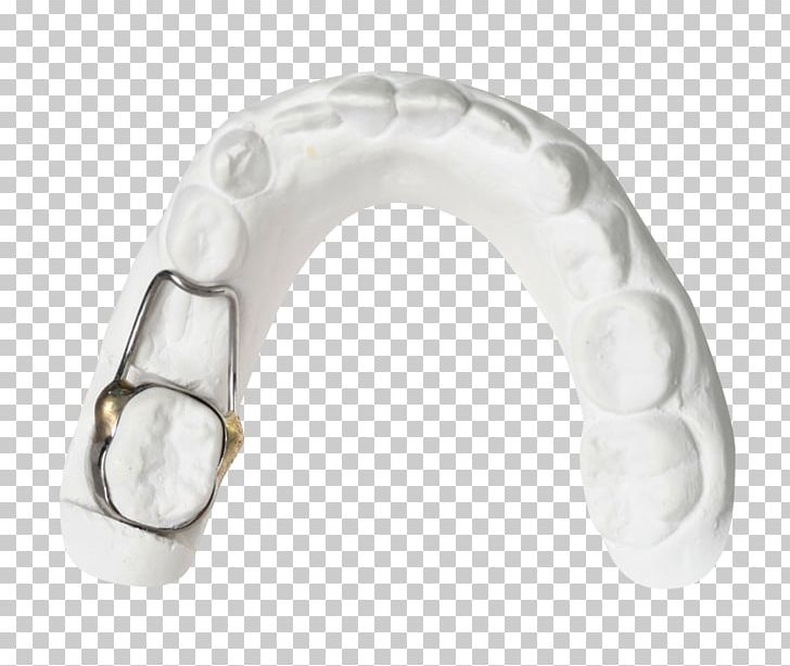 Tooth Whitening Mouth Dentistry Horse PNG, Clipart, Bionator, Body Jewellery, Body Jewelry, Computer Hardware, Dentistry Free PNG Download